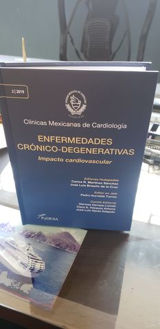 Acabado en cartoné